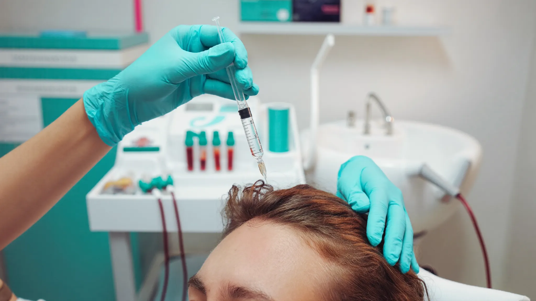 PRP bei Haarausfall in der Menopause