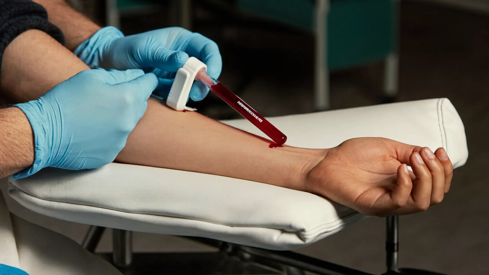 Blutabnahme am Arm zur Gewinnung von PRP